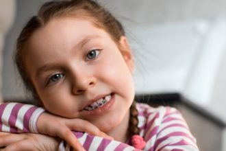 cum sa ti pregatesti copilul pentru primul aparat dentar scurt ghid pentru parinti 6793451da576c