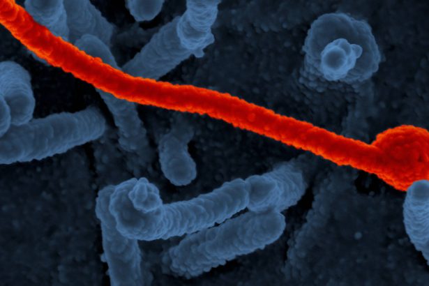 epidemie de ebola in estul africii un focar de imbolnaviri a izbucnit in uganda 679b9cb63489a