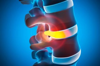 afectiuni ale coloanei vertebrale la copii si adolescenti diagnosticate cu ajutorul tehnologiei ct 3d 67b738c49913a