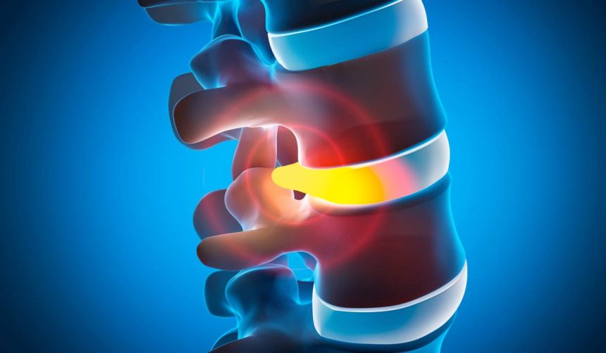 afectiuni ale coloanei vertebrale la copii si adolescenti diagnosticate cu ajutorul tehnologiei ct 3d 67b738c49913a