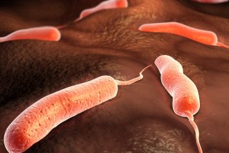 epidemie grava de holera in angola peste 4000 de persoane s au imbolnavit dintre care 150 au murit 67b4a8009362d