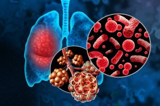 gripa implicata in 25 din cazurile de exacerbare a bolilor pulmonare cronice modificarile produse la nivelul cailor aeriene sunt mult mai dificil de gestionat si tratat 67a30ffbbdf91