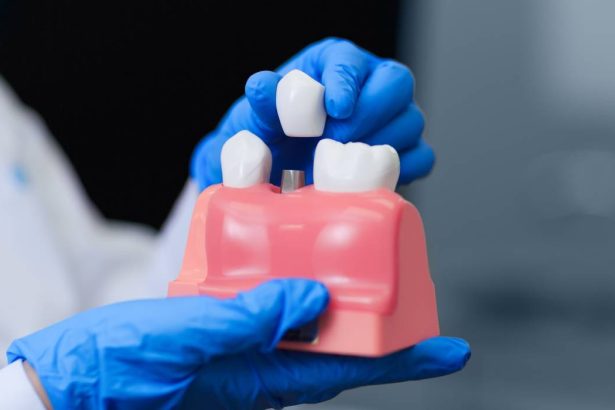 implantologia dentara de la a la z varsta inaintata nu este un obstacol pentru implanturile dentare 67b9b1974725f