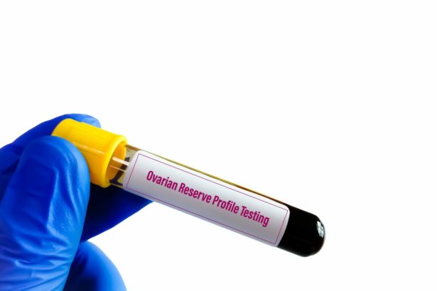 4 hormoni importanti care influenteaza rezerva ovariana si fertilitatea femeii 67db17babe7d3