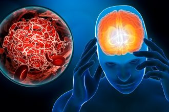 doua suplimente pe care sa nu le combini niciodata creste riscul de accident vascular cerebral 67d96ad3e56ae
