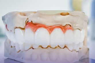 p dintii sensibili la frig afla cum tratamentele de desensibilizare dentara iti aduc confort 67c70aeb768cd