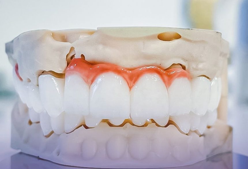 p dintii sensibili la frig afla cum tratamentele de desensibilizare dentara iti aduc confort 67c70aeb768cd