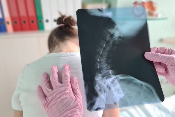 scolioza la copii cauze diagnostic tratament 67d00d2c30e22
