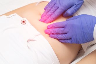tratamente eficiente pentru chisturile ovariene 11 remedii de facut acasa 67e43bbbdcafd