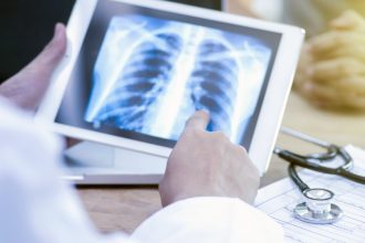 video pacientii nu isi recunosc simptomele tuberculoza face mii de victime in romania insa putini dintre bolnavi ajung la timp la medic 67e2512ee92b4