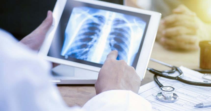 video pacientii nu isi recunosc simptomele tuberculoza face mii de victime in romania insa putini dintre bolnavi ajung la timp la medic 67e2512ee92b4