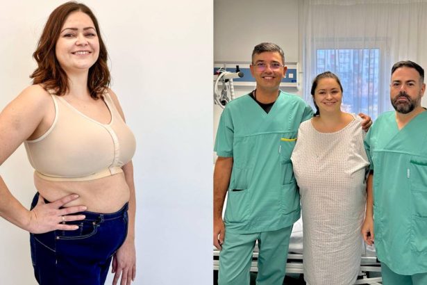 cazul impresionant al femeii care suferea de gigantomastie cum a ajuns de la cupa f la cupa c sanii imensi devenisera o povara 67f7bbec1f9b6