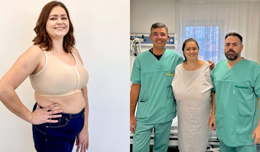 cazul impresionant al femeii care suferea de gigantomastie cum a ajuns de la cupa f la cupa c sanii imensi devenisera o povara 67f7bbec1f9b6