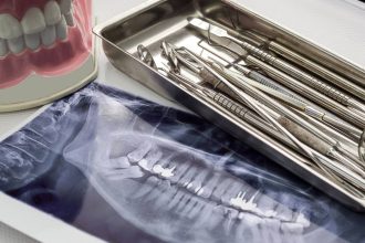 ortodontia digitala si viitorul tratamentelor personalizate cum schimba tehnologia abordarea pacientului adult 6808991d3f063