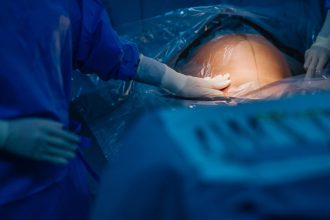 turcia interzice nasterile prin cezariana in clinici private regimul erdogan vorbeste despre nevoia de crestere a natalitatii 6807b8594a498