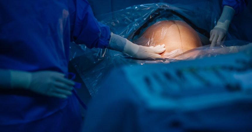 turcia interzice nasterile prin cezariana in clinici private regimul erdogan vorbeste despre nevoia de crestere a natalitatii 6807b8594a498