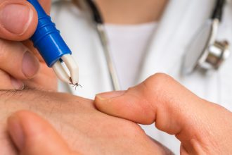 video nu mi am dat seama pericolul ascuns din iarba sute de romani au ajuns la spital in ultimele zile cu muscaturi de capuse 680dc9520092f
