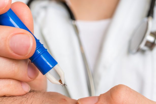 cum scoti corect o capusa si cand trebuie sa mergi la medic avertismentul specialistilor nu se folosesc substante pe piele 68368bb25f153