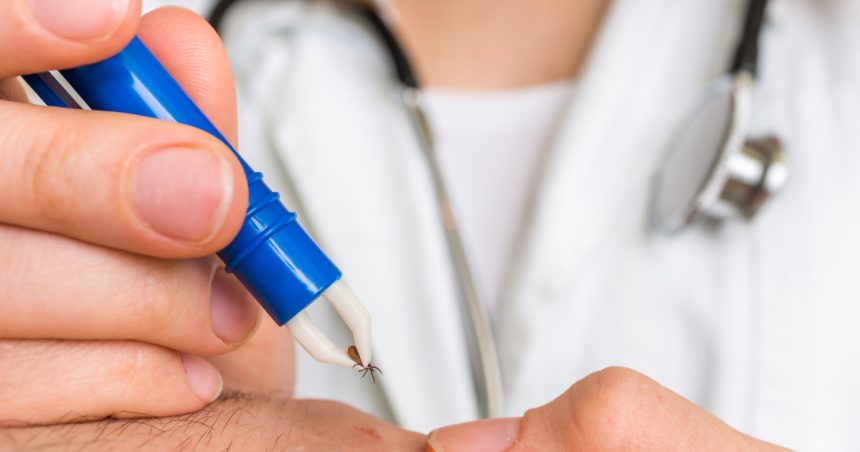cum scoti corect o capusa si cand trebuie sa mergi la medic avertismentul specialistilor nu se folosesc substante pe piele 68368bb25f153