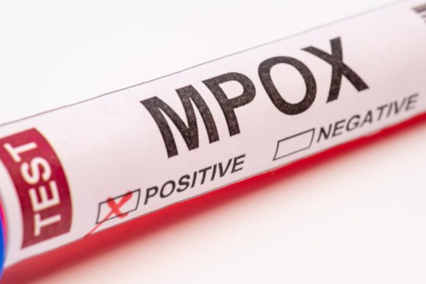 macedonia de nord a raportat primele sale doua cazuri de infectare cu mpox apelul autoritatilor catre cetateni 683090ff09893