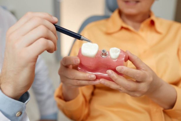 p implant dentar cele mai moderne tehnologii de implantologie 6814e0161bb62