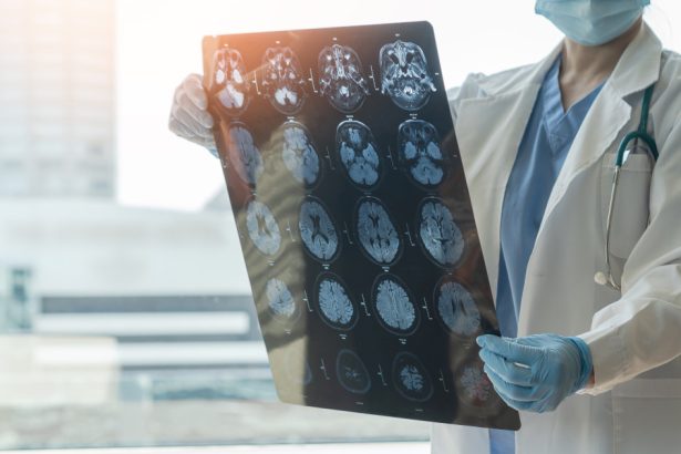 speranta pentru bolnavii de parkinson si alzheimer o molecula care blocheaza moartea celulara descoperita de cercetatori australieni 682c139ea5c05