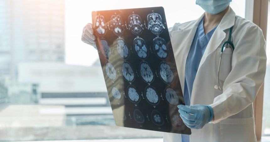 speranta pentru bolnavii de parkinson si alzheimer o molecula care blocheaza moartea celulara descoperita de cercetatori australieni 682c139ea5c05