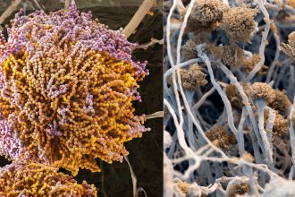 un nou supermicrob ucigas ameninta planeta si se raspandeste intr un ritm alarmant de ce sunt infectiile fungice atat de periculoase 682972f6ba098