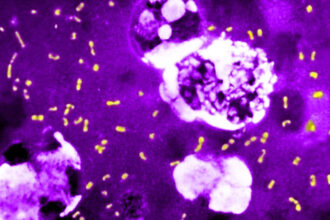 cum a evoluat cea mai letala bacterie din toate timpurile ca sa continue sa omoare milioane de oameni si sa supravietuiasca pana astazi 683e8198e5c14