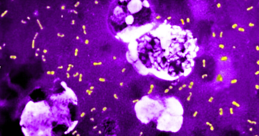 cum a evoluat cea mai letala bacterie din toate timpurile ca sa continue sa omoare milioane de oameni si sa supravietuiasca pana astazi 683e8198e5c14