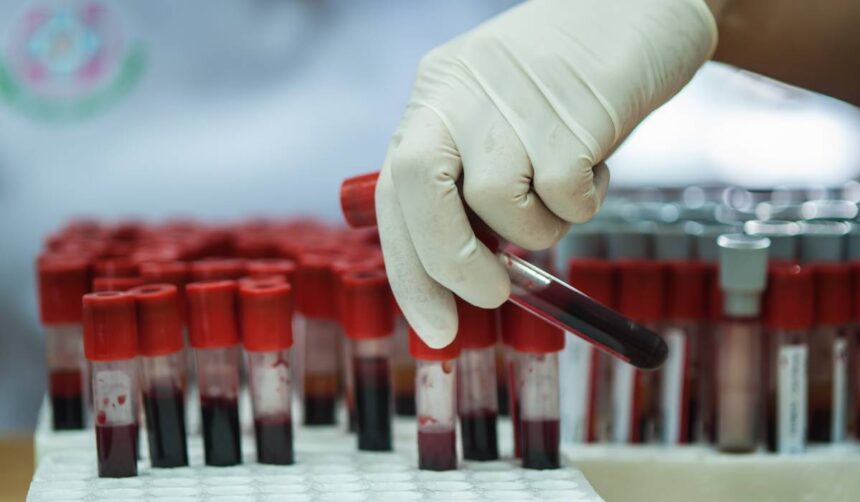 de ce nu este recomandat sa iti faci analizele imediat dupa vacanta explicatiile unui medic de laborator 685290479a42b