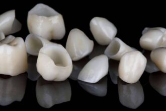 p coroanele dentare explicate ce trebuie sa stii despre fiecare tip 684d3c38cb3c0