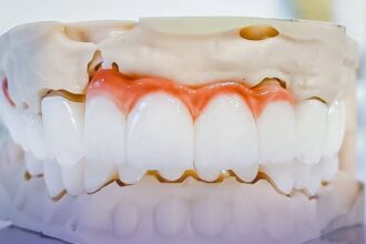 p estetica fara compromis de ce implantul dentar e cea mai naturala solutie 6853d3b7200c5