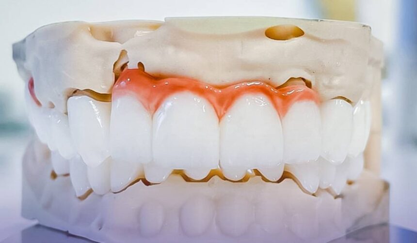 p estetica fara compromis de ce implantul dentar e cea mai naturala solutie 6853d3b7200c5