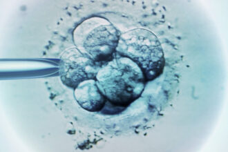ceasul biologic al barbatilor legat de avorturile spontane in cazul fertilizarii in vitro 686c0ff0c0686