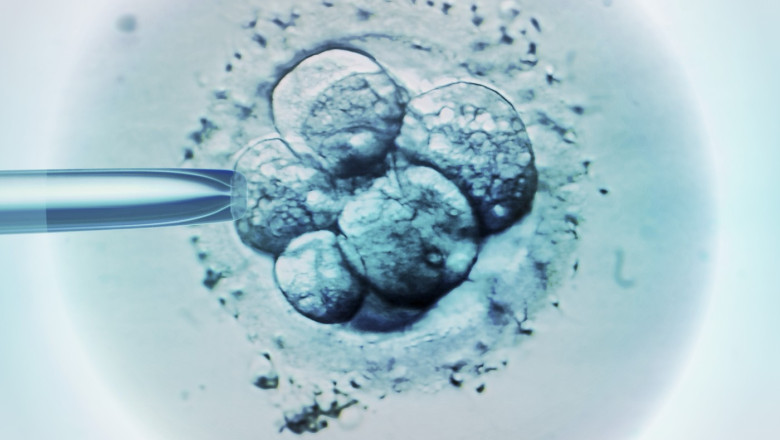 ceasul biologic al barbatilor legat de avorturile spontane in cazul fertilizarii in vitro 686c0ff0c0686