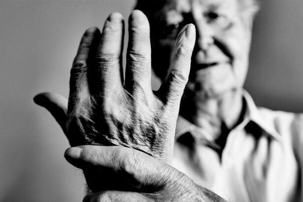 clinical test may predict best rheumatoid arthritis biologic for each individual 686e3e0a5741a