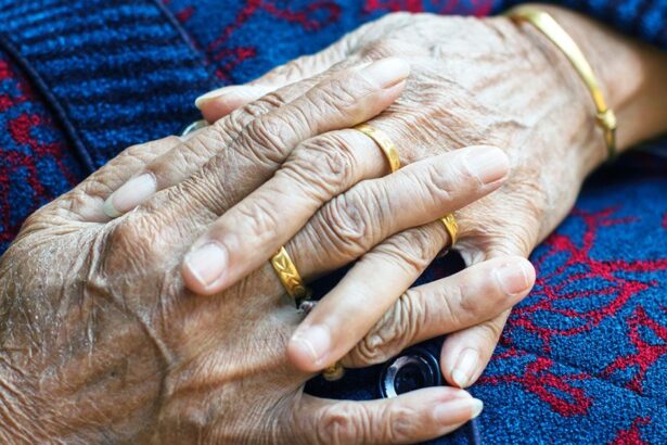 dementia may take 3 5 years to diagnose after symptoms begin but why 688a218893765