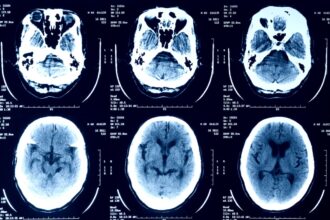episource is notifying millions of people that their health data was stolen 687556d0b8bbc