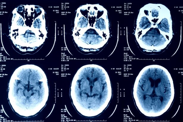 episource is notifying millions of people that their health data was stolen 687556d0b8bbc