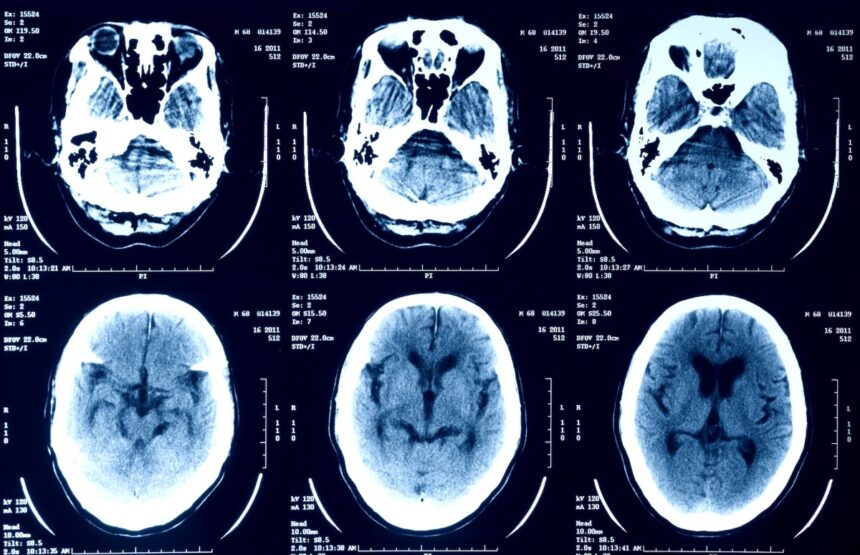 episource is notifying millions of people that their health data was stolen 687556d0b8bbc